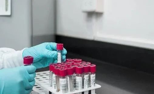 中山親子鑒定多久才能出結(jié)果？