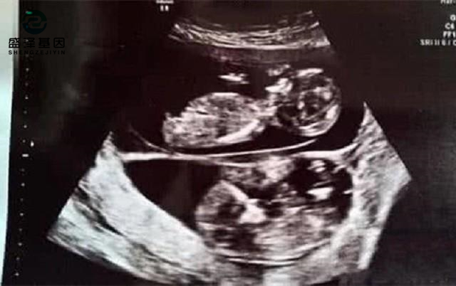 廣東男子做親子鑒定,竟發(fā)現(xiàn)自家雙胞胎有一個(gè)不是自己的?! 廣東男子做親子鑒定,竟發(fā)現(xiàn)自家雙胞胎有一個(gè)不是自己的?!