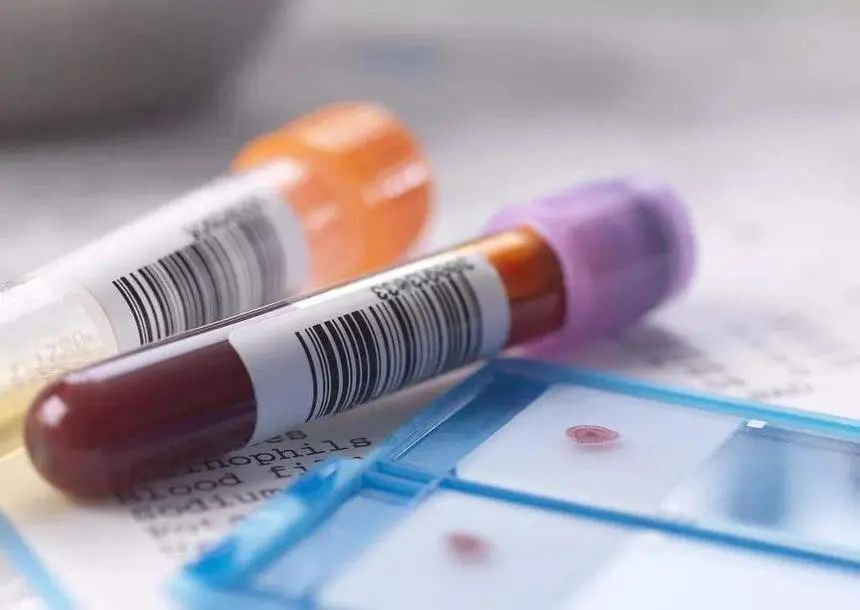 親子鑒定和血型有關系嗎？給孩子做親子鑒定需要什么樣本？