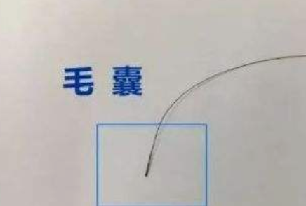 什么是親子判定？小梅與陳姑娘的故事