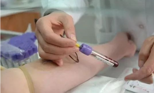 無創(chuàng)胎兒親子鑒定抽血需要孕婦空腹嗎？