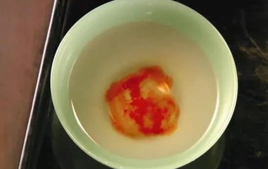 親子鑒定檢驗(yàn)血型血痕，被鑒定人應(yīng)了解自己或近親屬有無遺傳病史