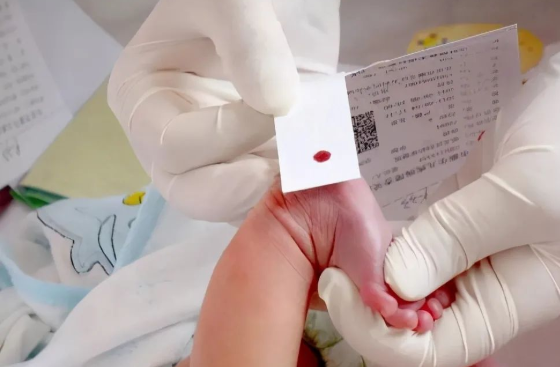 孩子出生前與出生后做親子鑒定檢測堿基有什么不同？