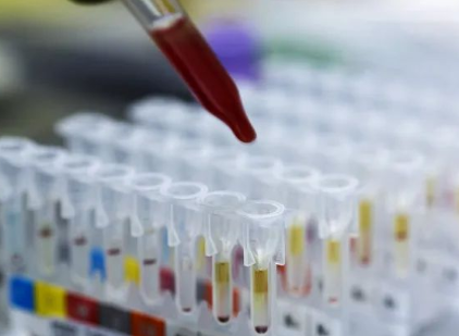 探秘個人親子鑒定和司法親子鑒定，什么是兩聯(lián)體、三聯(lián)體？