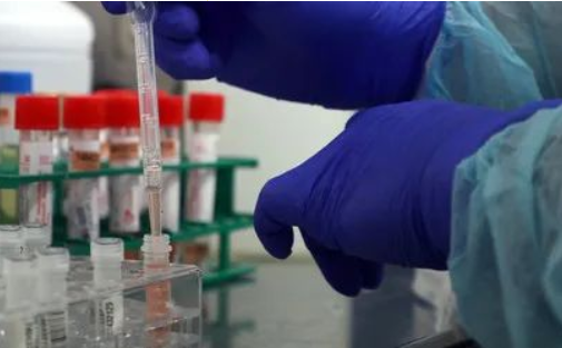 為您細(xì)數(shù)男方女方做親子鑒定的各種原因，包括：撫養(yǎng)費(fèi)和第三者...