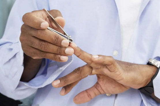 指甲是否含有DNA，可作為親子鑒定樣本嗎？