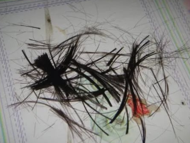 剪下來的頭發沒有毛囊可以做親子鑒定樣本嗎？