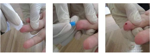 在家怎樣做親子鑒定最簡單?毛發樣本采集好后放入標記好的信封內 在家怎樣做親子鑒定最簡單?毛發樣本采集好后放入標記好的信封內