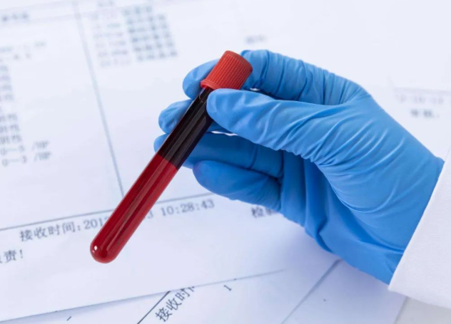 兄妹之間可以做親子鑒定嗎?兄弟之間可以做親緣關(guān)系鑒定嗎? 兄妹之間可以做親子鑒定嗎?兄弟之間可以做親緣關(guān)系鑒定嗎?