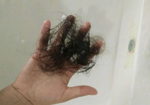 毛發可以做親子鑒定檢材嗎,怎么采集樣本才可以? 毛發可以做親子鑒定檢材嗎,怎么采集樣本才可以?