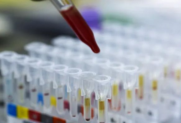 DNA親子鑒定會(huì)出錯(cuò)嗎？根據(jù)樣本檢測(cè)位點(diǎn)出錯(cuò)的概率是多少呢？